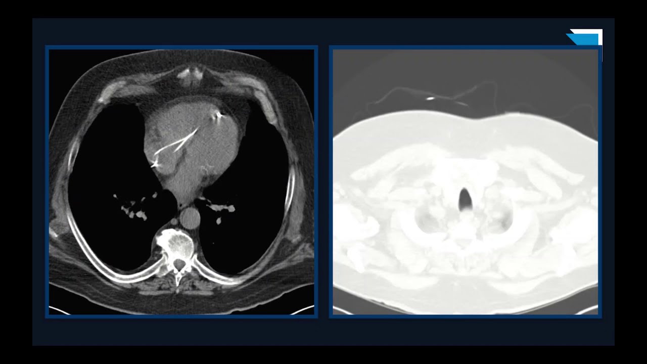 Great Calls! | 15 Minute Radiology CME