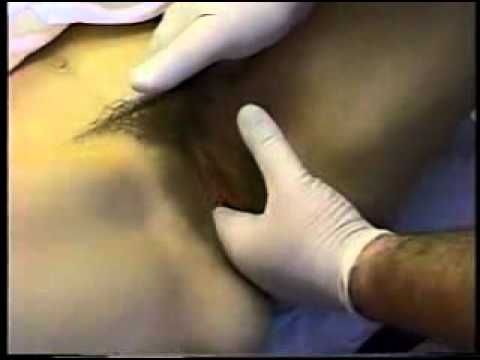Pemeriksaan Vaginal Bimanual