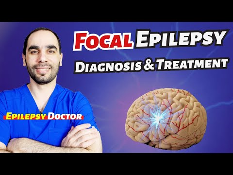 Video: Adakah sawan focal epilepsi?