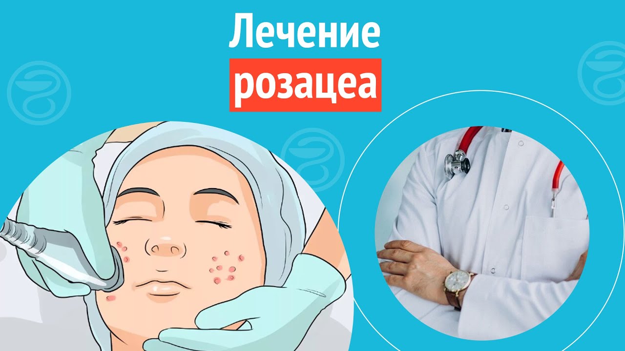 ✅ Лечение розацеа. Клинический случай №1063