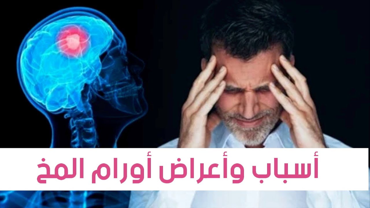 ورم الدماغ | الأعراض والأسباب