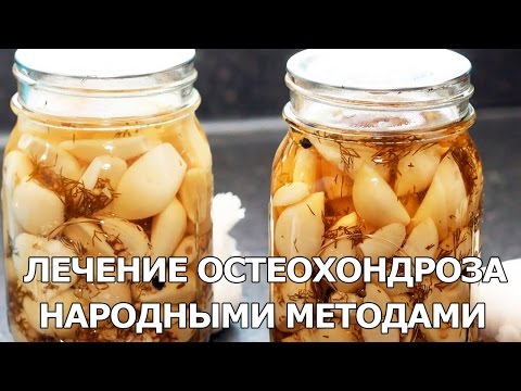 Лечение остеохондроза народными методами