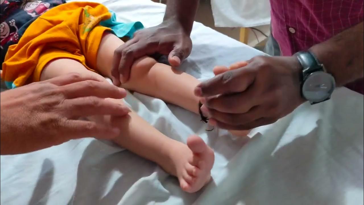 how-to-treat-child-muscular-disorder-cp-physiotherapy-cp-physiotherapy