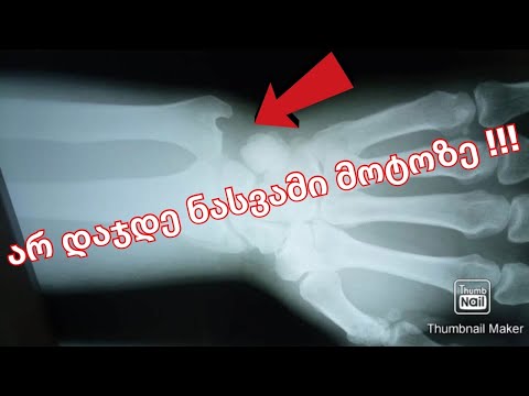 არ დაჯდე ნასვამი მოტოზე ! / Kazuxa Films 4k