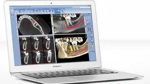 How to draw #Panoramic Curve Using #Romexis #CBCT Software ? By Dr.Sally Mansour
