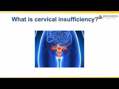 Video: Hjelper progesteron cervical inkompetanse?