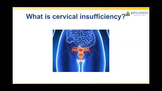 Treatment of Cervical Insufficiency