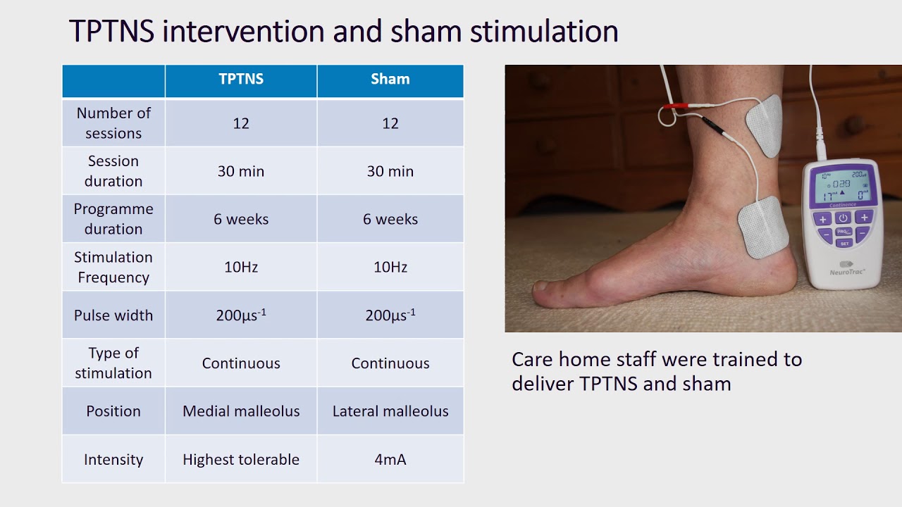 ICS 2020 Abstract 464 The ELECTRIC trial ELECtric Tibial nerve