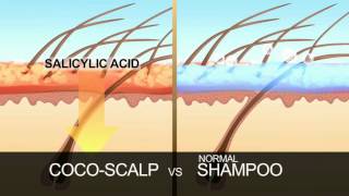 Coco Scalp 30sec TVC