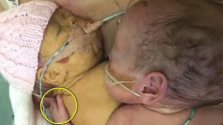Krankenschwester legt gesundes Baby neben sterbenden Zwilling, was passierte war herzzerreißend