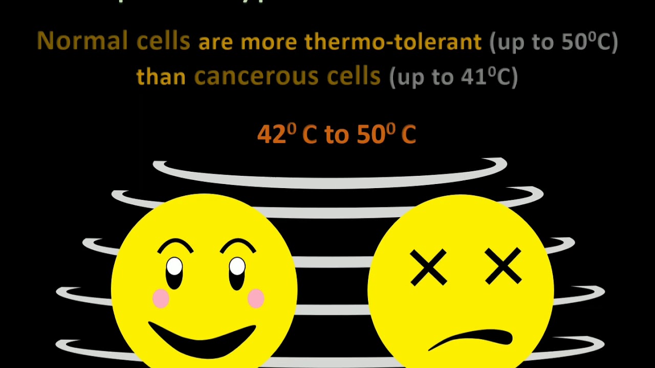 Thermal therapies nanoparticles mediated hyperthermia as a