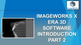 ImageWorks X era 3D Software Introduction - Part 2