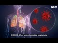 Así ataca el #Coronavirus al cuerpo humano - #ExclusivoMSP