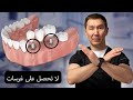 لا ت جر ب زراعة أسنان قبل أن تعرف هذا أطباء الأسنان لا يخبرونك الحقيقة لا ت جر ب زراعة أسنان قبل أن تعرف هذا أطباء الأسنان لا يخبرونك الحقيقة