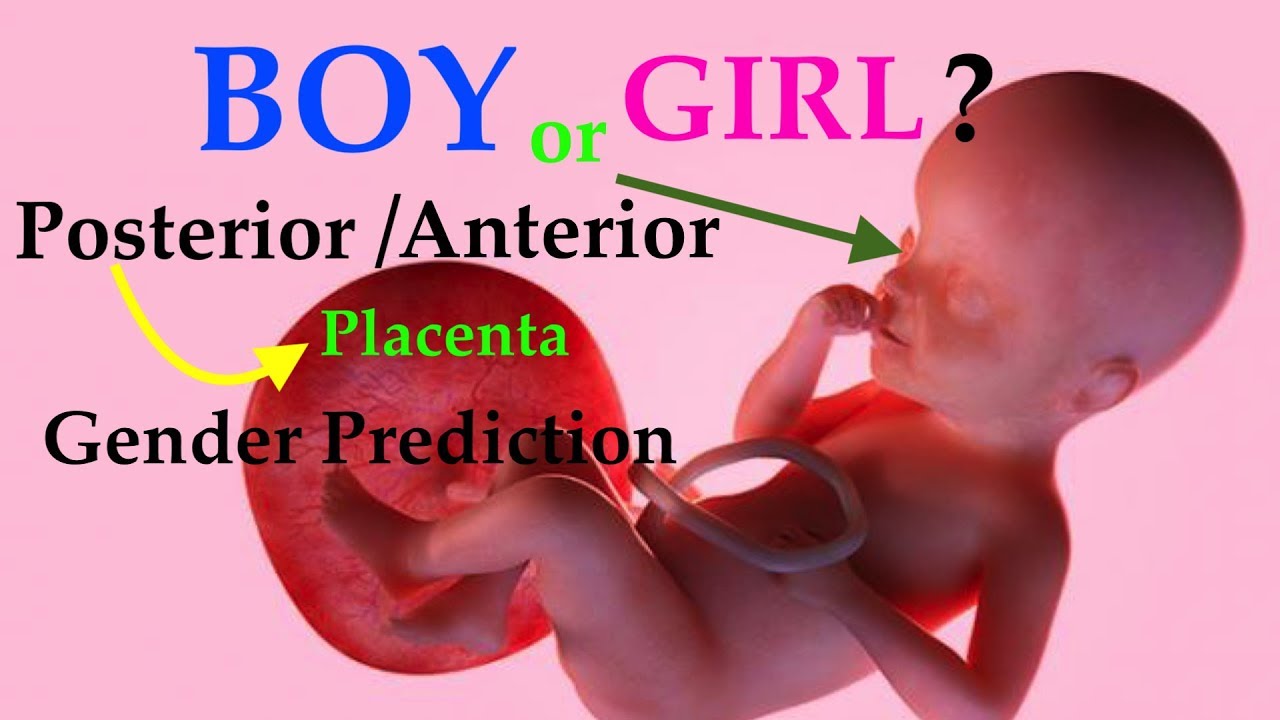 Baby gender prediction from placenta location anterior or posterior