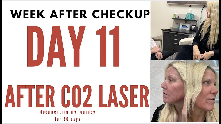 C02 LASER- DAY 11- QUESTIONS AND ANSWERS- COME TO ...
