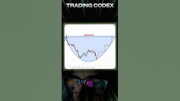 Learn. Adapt. Conquer the Market #optionstrading #optiontrading #tradingstrategy #trading #binary