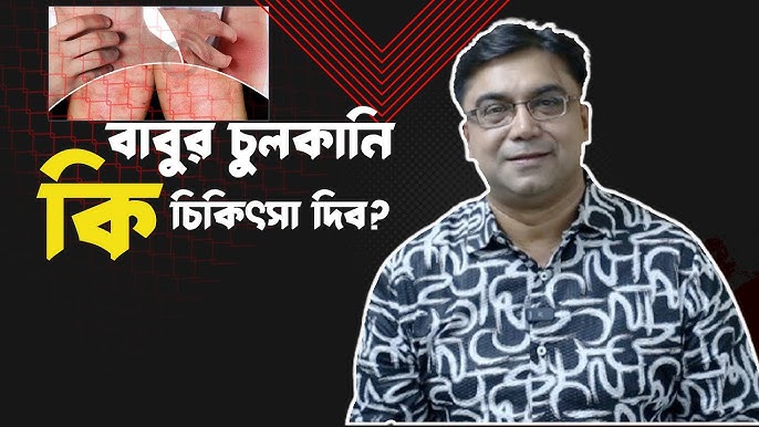 Saqich bilan jinsiy aloqa