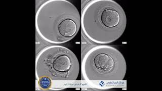 Embryo development - مراحل تطور الجنين