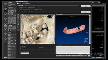 Incorporating STL file into CBCT Diagnosis - HDX WILL E-Learning Series 3th Session