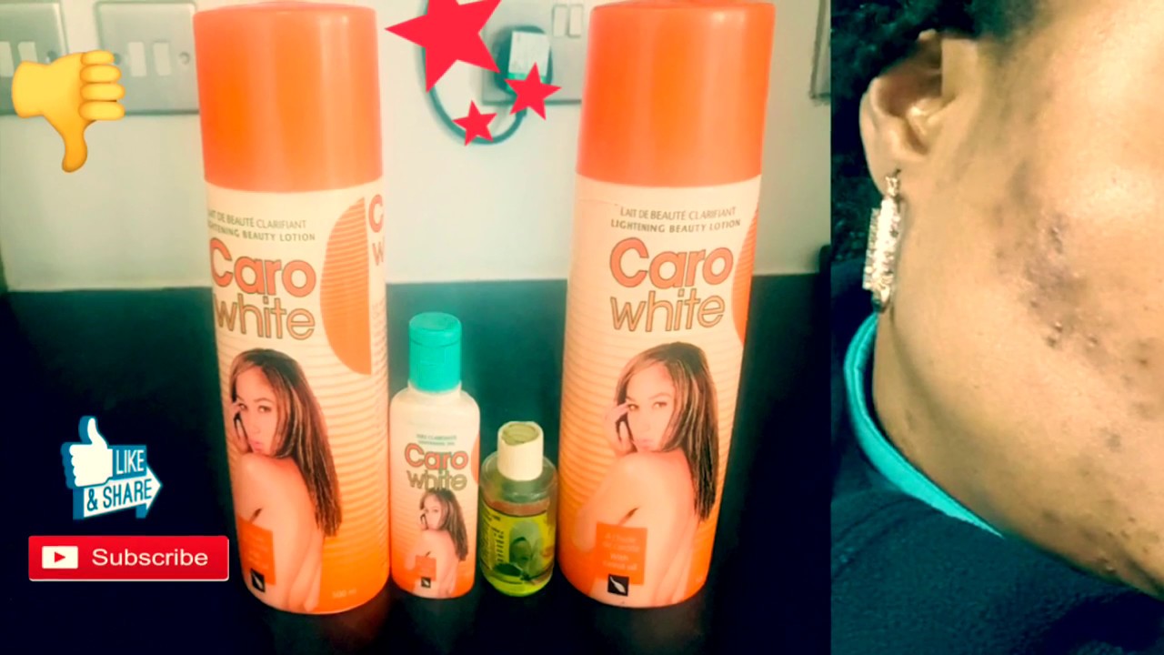 CARO WHITE CREAM HONEST REVIEW AND WHAT THE CREAM DID TO CARO WHITE CREAM HONEST REVIEW AND WHAT THE CREAM DID TO