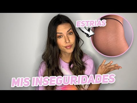 MIS INSEGURIDADES - Daniela Salazar