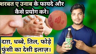 Sharbat E Unnab Ke Fayde, शरबत ए उन्नाब को कैसे और कब प्रयोग करे। दाग़ धब्बे दूर करने का देसी शरबत