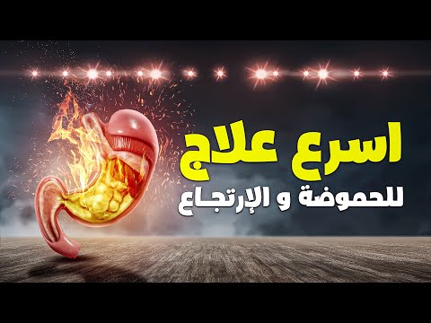 انسي مشاكل الحموضة