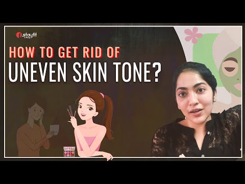 Como eliminar manchas na pele | Dicas da Ramya