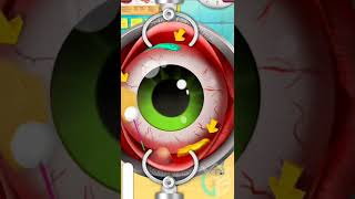 Eyes Clean in Er hospital Surgery All level mobile iOS Android game walkthrough [LIZARD GAMING] screenshot 5