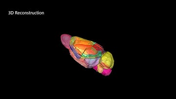 3D reconstruction of a mouse brain