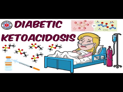 Clinical disorders linked to the carbohydrate Metabolism: Diabetic Ketoacidosis