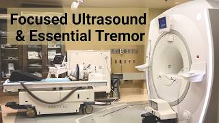 Essential Tremor Treatment- Focused Ultrasound in Colorado