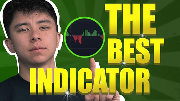 Why You Should Use a MACD