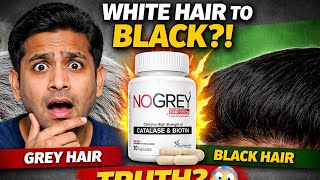 Does This Capsule Really Turn White Hair Black? | NoGrey EXPOSED | سفید بال ختم؟