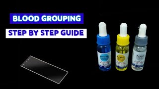 How to do blood grouping- Slide method| |MEDICAL LABORATORY SCIENCE
