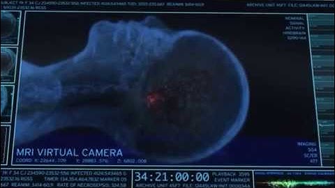 The Walking Dead Brain Scan Scene