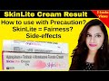 SKINLITE CREAM REVIEW| HOW TO USE SKIN LIGHT|skinlite cream|SKIN LIGHT CREAM PRECAUTIONS| #skinlite