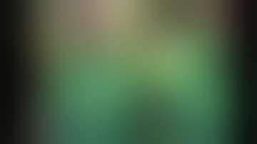 The Use of Demineralized Bone Matrix and MSC Concentration for the Treatment of the Bone Cysts