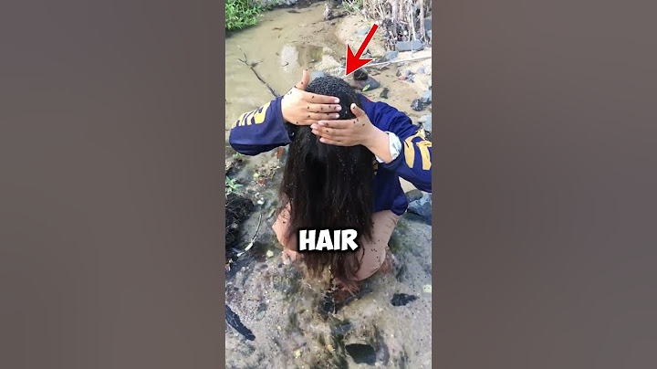 😱 TICKS in HAIR! Is it REAL? 😲 #shorts