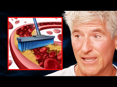 Eliminate Visceral Fat to OPEN UP Arteries & Improve Blood Flow | Dr. Sean O’Mara