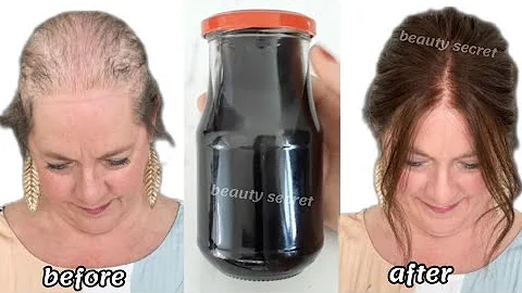 Spray it on your hair for 2 days only and your hair will grow abundantly without stopping.