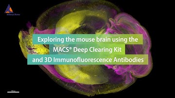 Exploring the mouse brain using the MACS® Deep Clearing Kit and 3D Immunofluorescence Antibodies