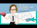 I CARE FOR YOUR BRAIN Facebook LIVE! Cerebellar Stroke