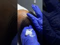 HairPRP