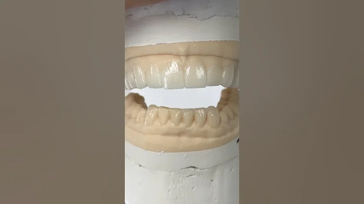 Wax-Up Overview @EnvisiontecMain #envisiontec #dental #teeth #smile #lsk121shorts #shortvideo