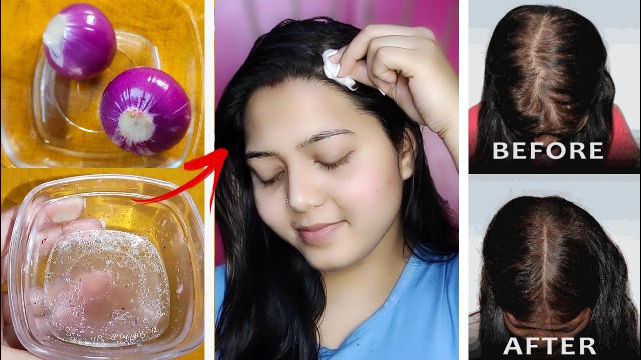 যেটা কেউ জানেনা পেঁয়াজের রসকে মাথায় শুধুমাত্র এইভাবে লাগাও আর