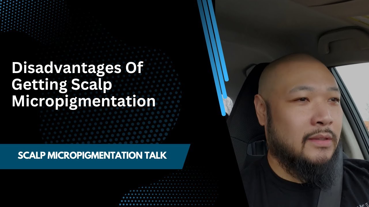 Disadvantages of Getting Scalp Micropigmentation
