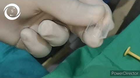 Proper way of loading iol in injector and how to re use an injector