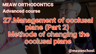 27.Management of occlusal plane (Part 2) - Methods of changing the occlusal plane News